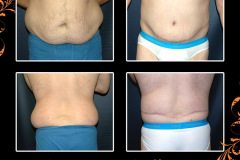 bodylifts-0479