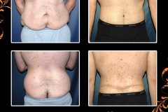 bodylifts-2379