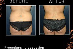lipo-3070
