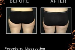 lipo-6107