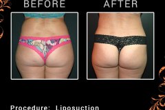 lipo-6293a