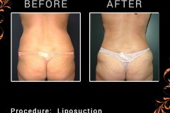 lipo-6300