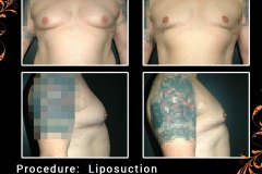 lipo-6316b