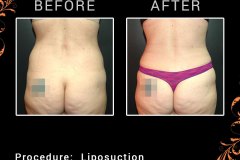 lipo-6373
