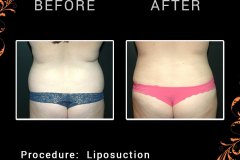lipo-6699-c