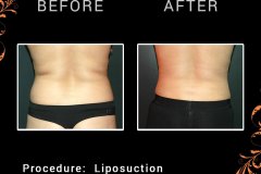 lipo-6742-c