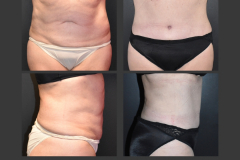 18 - 1