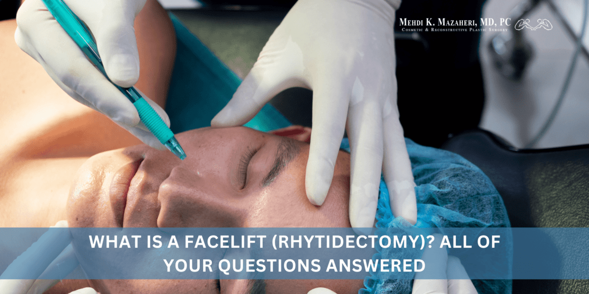 What Is a Facelift (Rhytidectomy) All of Your Questions Answered