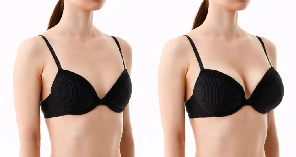 Benefits of breast lift and breast implant