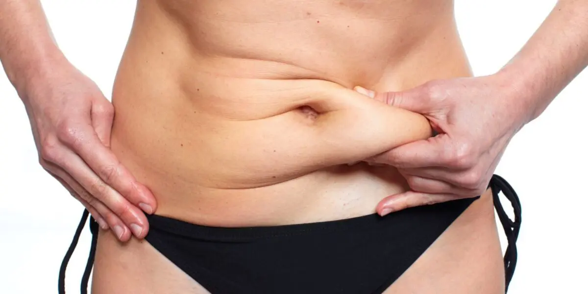 tummy tuck after C Section