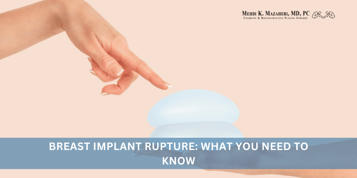 Breast Implant Rupture What You Need to Know