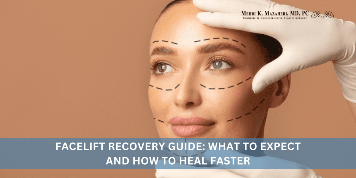 Facelift Recovery Guide What to Expect and How to Heal Faster