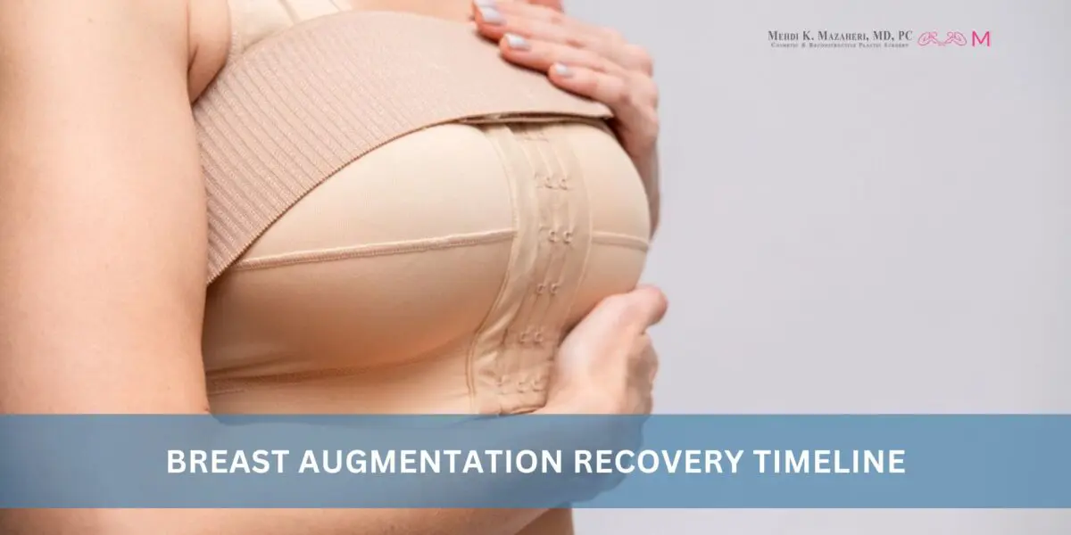 Breast Augmentation Recovery Timeline