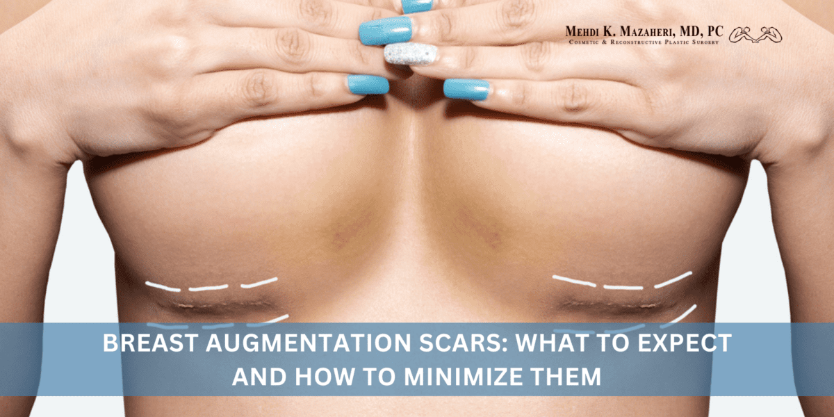 Breast Augmentation Scars