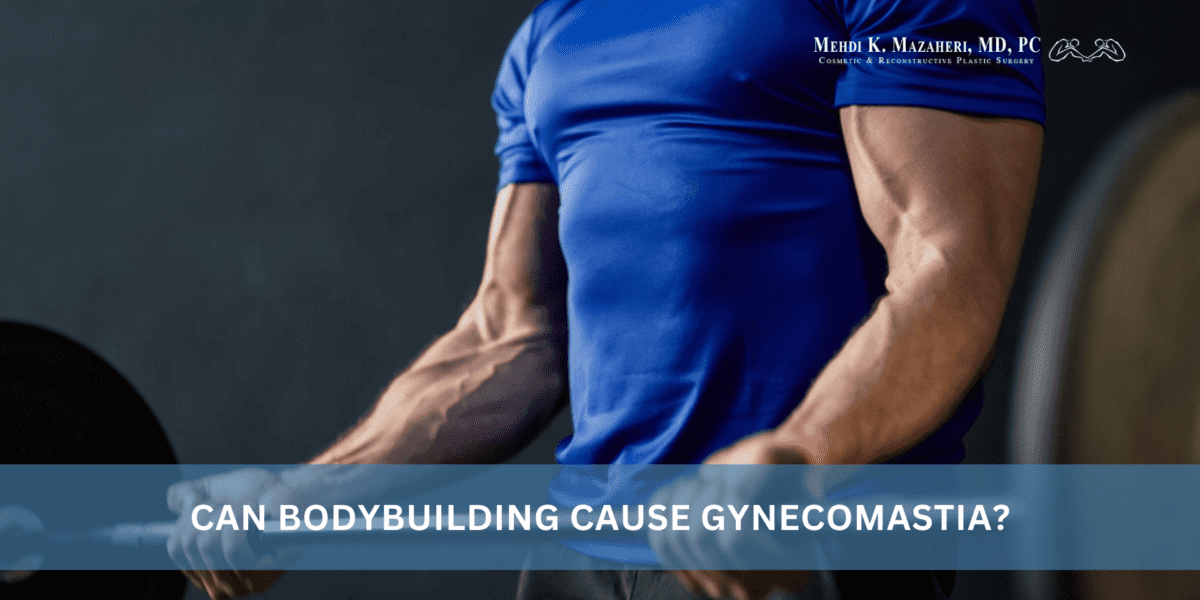 image of a man in a tight shirt lifting a barbell with heavy weights on it, depicting gynecomastia in bodybuilders