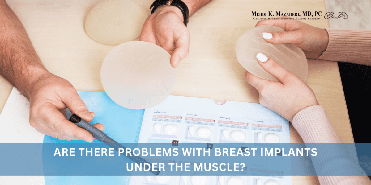 Are There Problems With Breast Implants Under the Muscle?
