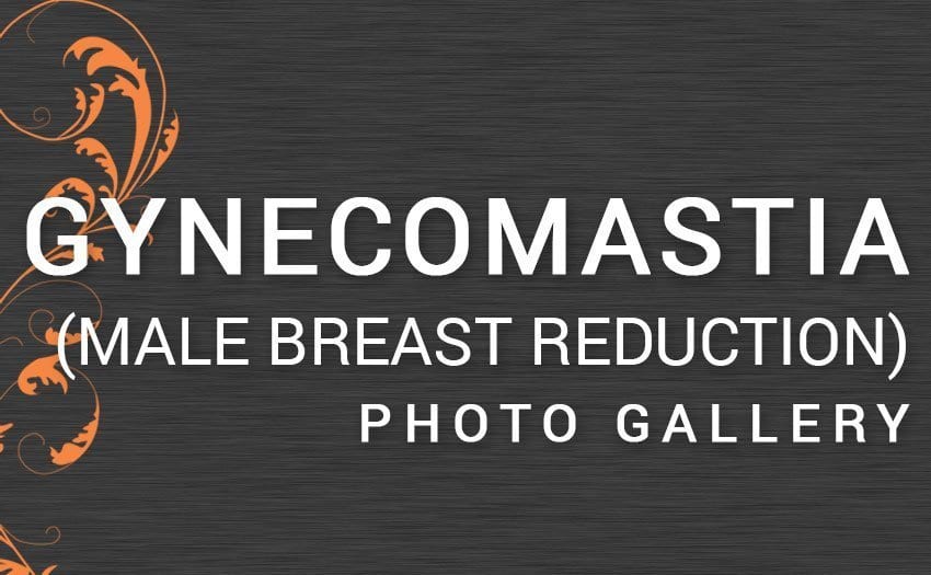 PHOTO GALLERY Dr. Mazaheri Scottsdale's Premier Plastic Surgeon