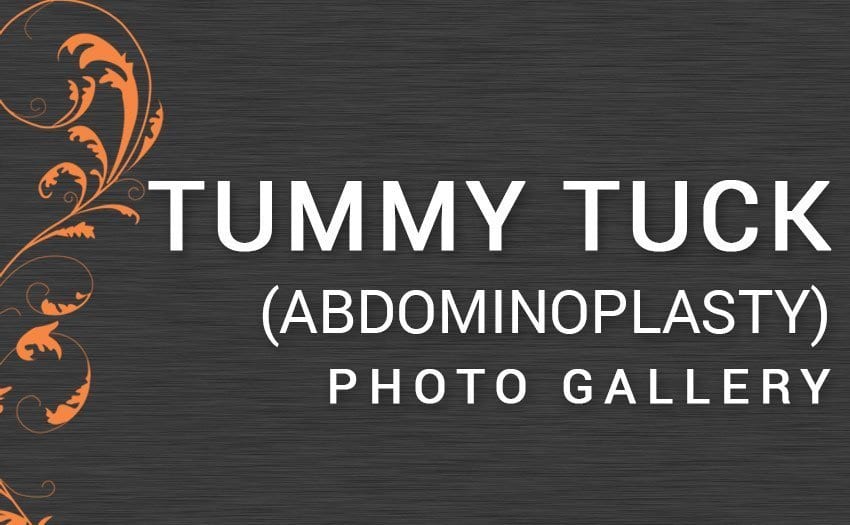 PHOTO GALLERY Dr. Mazaheri Scottsdale's Premier Plastic Surgeon