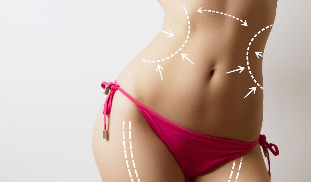 liposuction-benefits