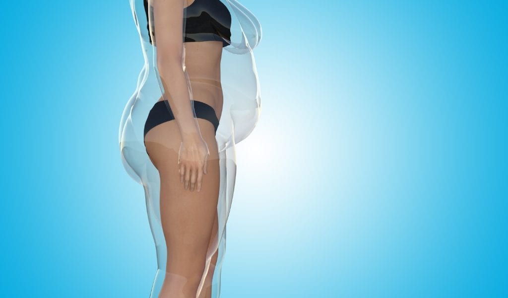 Liposuction-Guide