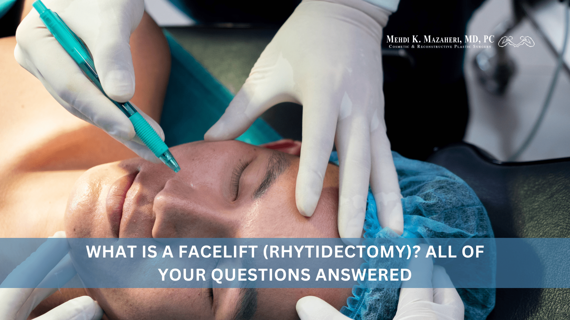 What Is a Facelift (Rhytidectomy) All of Your Questions Answered