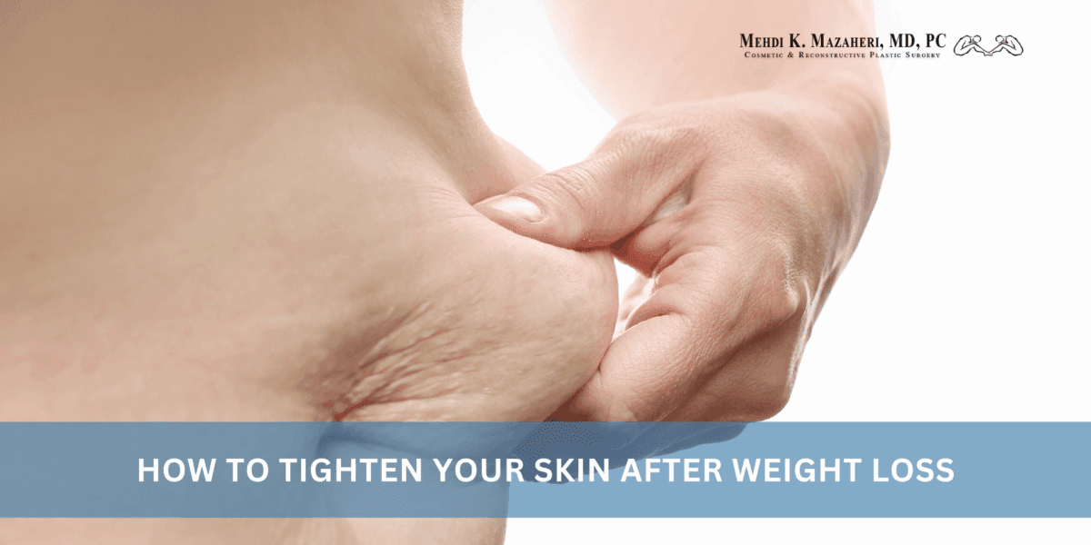How to Tighten Your Skin After Weight Loss