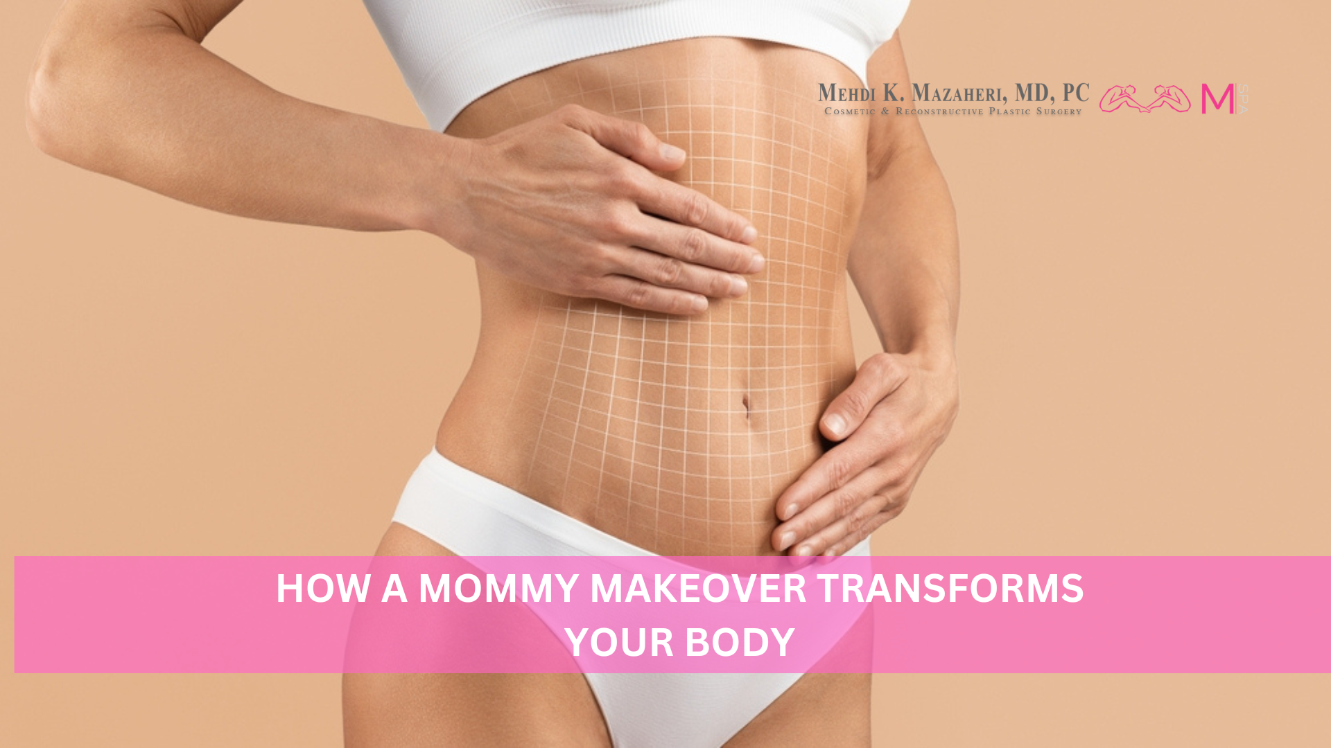 Transform your body with mommy makeover