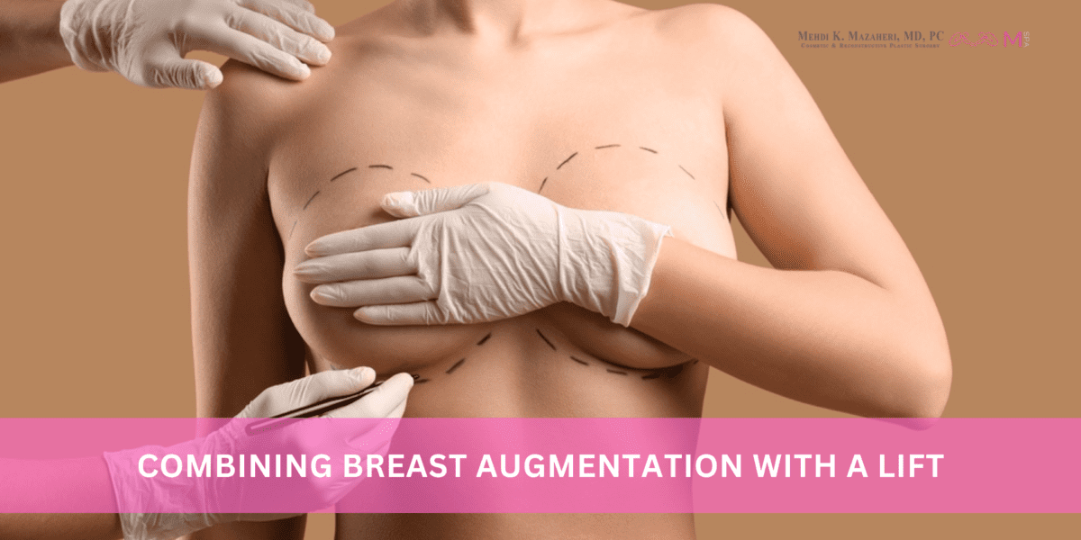 combining breast augmentation with breast lift