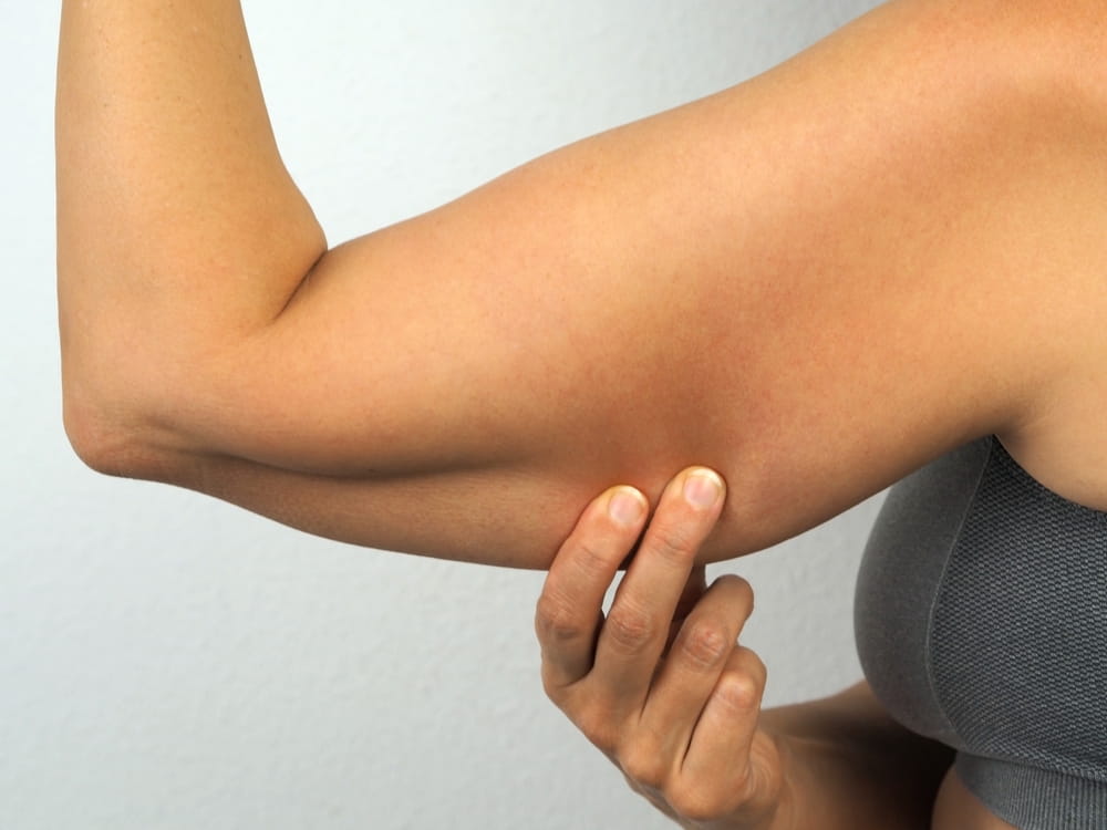 Arm Lift Surgery in Scottsdale